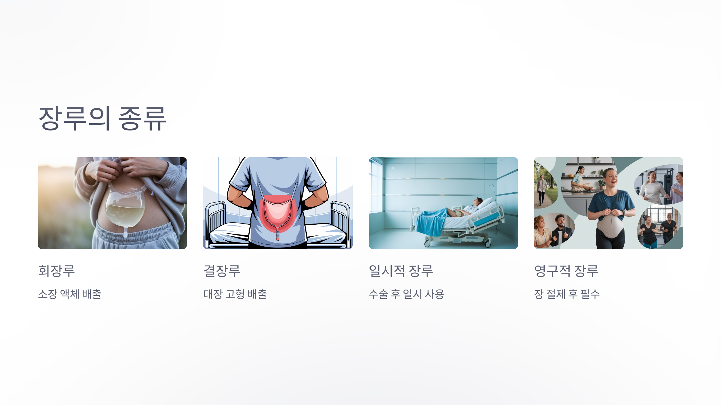 장루의 종류