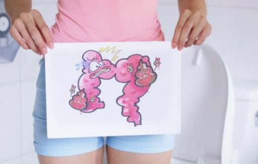 변비에 좋은 음식 해결방법 좋은 운동 등 총정리(24년 Ver)