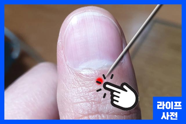 체 했을때 손따기 위치