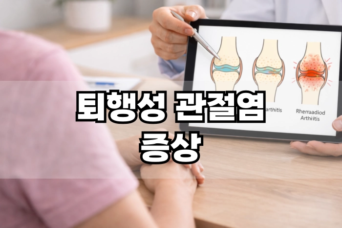 퇴행성 관절염 증상