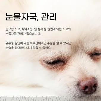눈물이 자주 나는 이유에 대한 안과정보_28