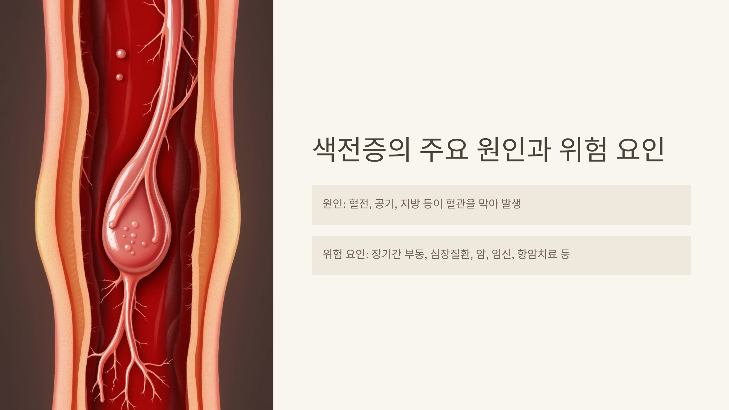 색전증의 주요 원인과 위험 요인