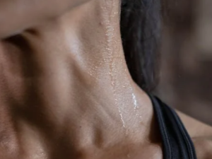 땀띠 없애는 방법