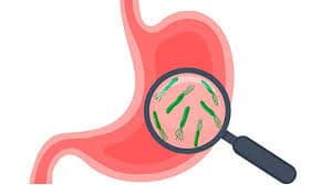 장누수증후군(leaky gut) – 현대인의 숨은 장 문제