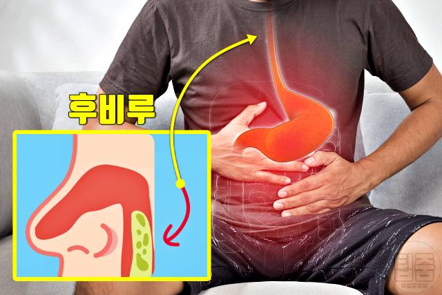 콧물 목 뒤로 넘어가요 후비루 원인 위산역류