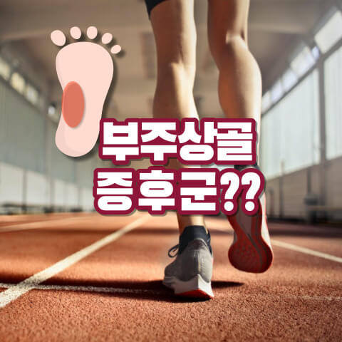 부주상골 증후군 원인과 증상