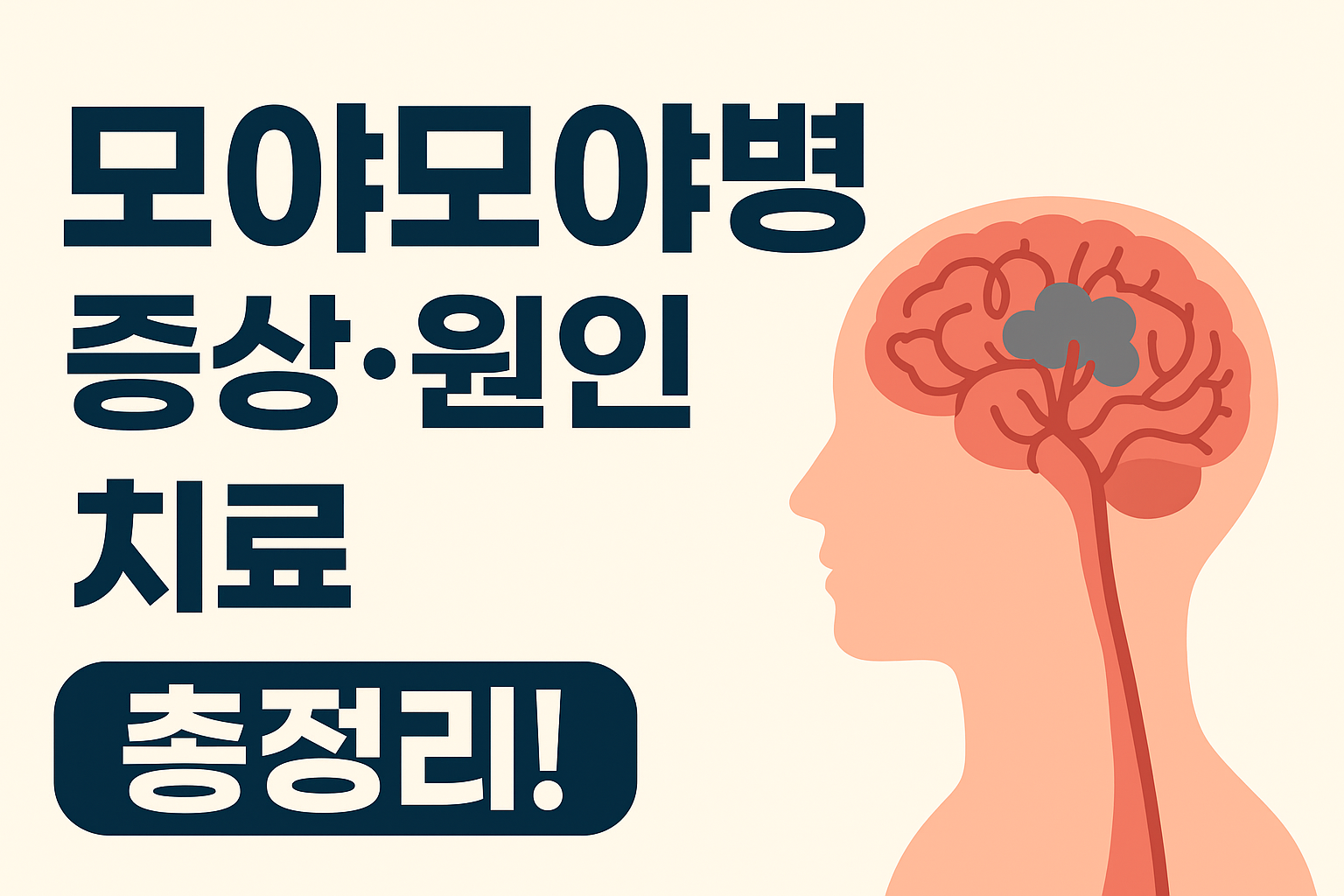 모야모야병 증상 원인 치료 문구이미지