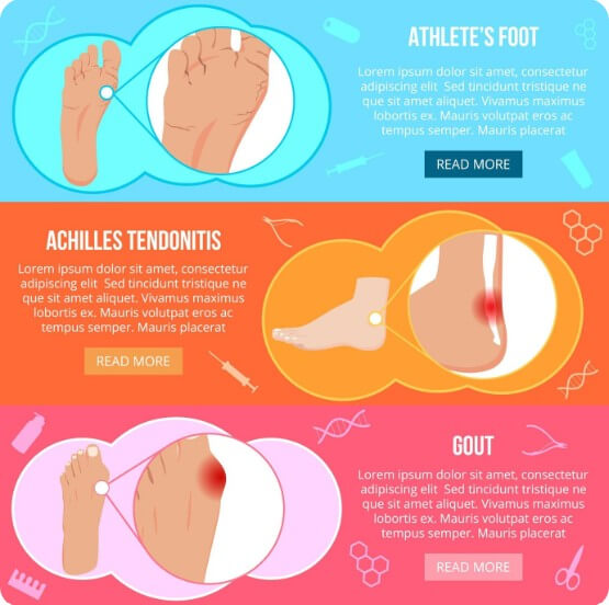 무지외반증 증상 설명