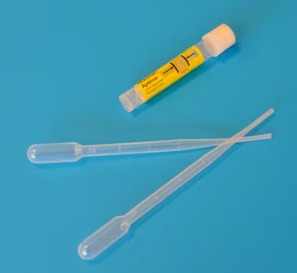 만성 신우신염 진단 기준 합병증 관리 방법