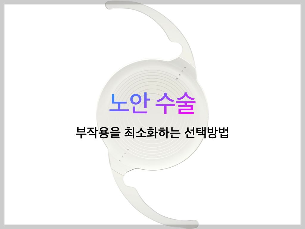 노안수술 부작용 최소화 하는 법