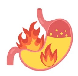 역류성 식도염 치료제