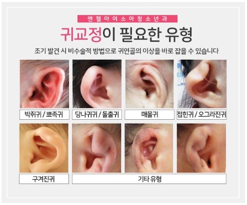 소아귀