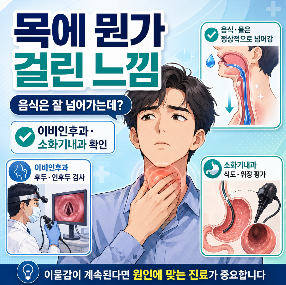 목에 뭔가 걸린 느낌이 계속되지만 음식과 물은 잘 넘어가는 목 이물감과 이비인후과&middot;소화기내과 진료를 표현한 메디컬 인포그래픽