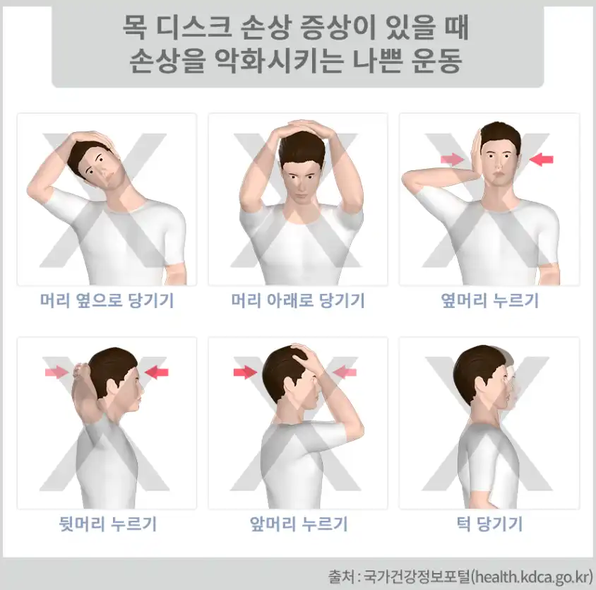 목디스크에나쁜운동-이미지