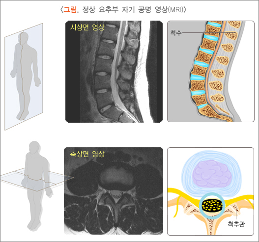 정상 요추부 자기공명영상