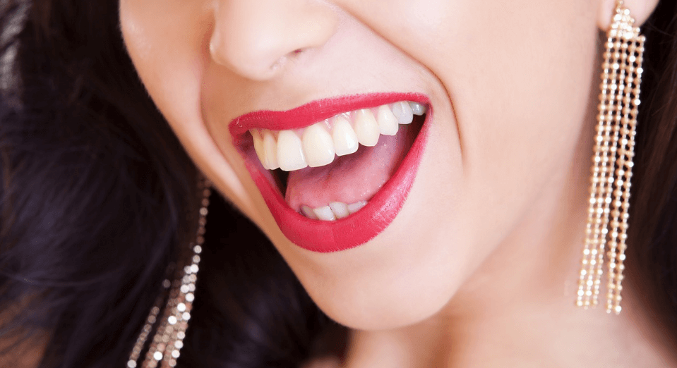 치아가 아름다운 여성이 입을 환하게 벌리고 웃고 있다