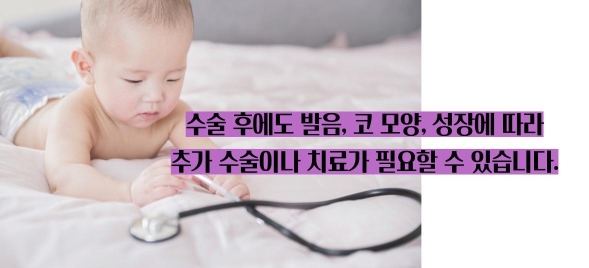 구순구개열 수술 유전