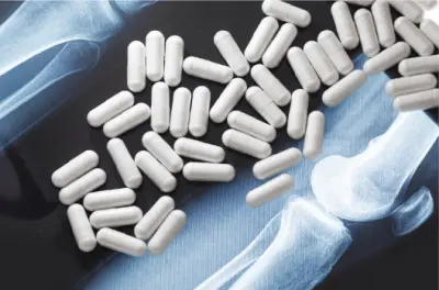 무릎관절에 좋은 영양제 추천 Best 7