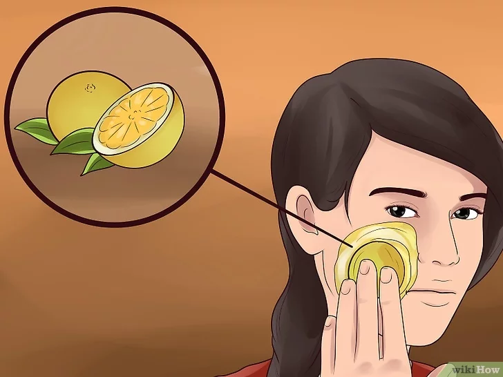 기미 잡티 제거