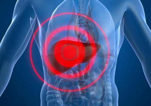 간이 나빠지면 나타나는 증상