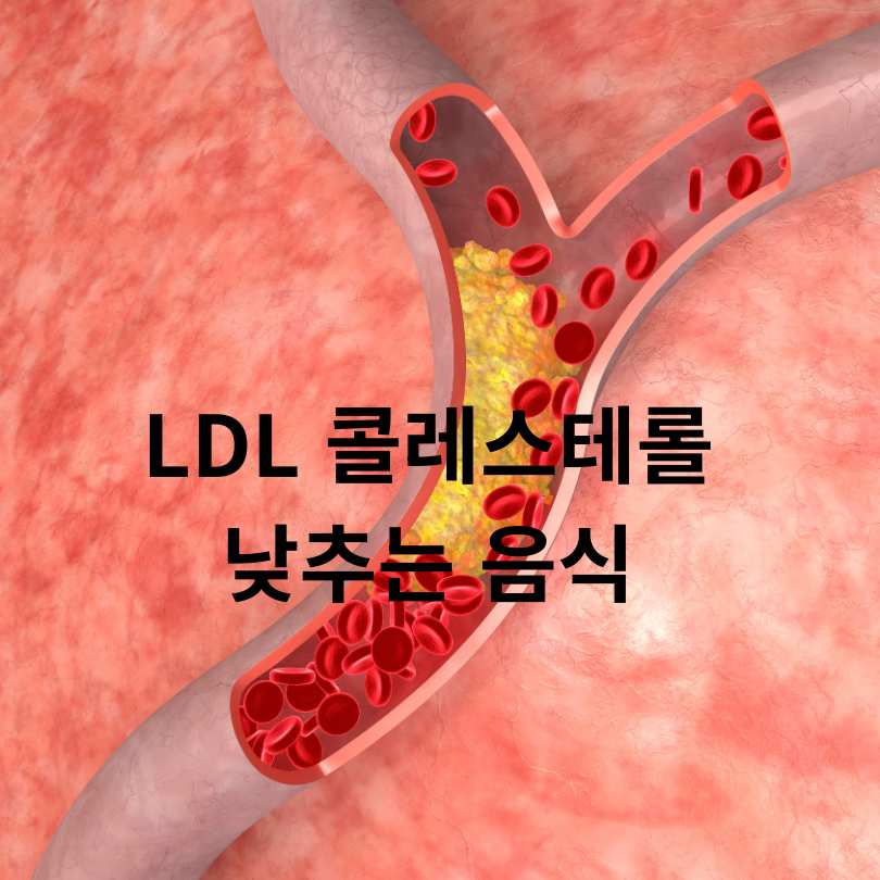 LDL 콜레스테롤 낮추는 음식
