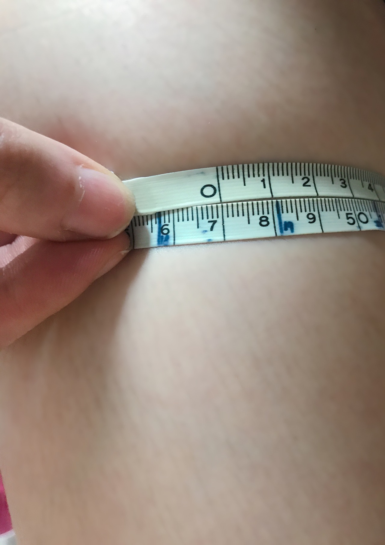 팔뚝 지방분해 주사 후기