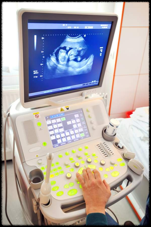 난임시술 정부 지원금 반환 정책, 사실일까?