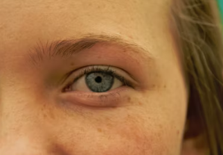 눈썹 이식 비용 가격 부작용