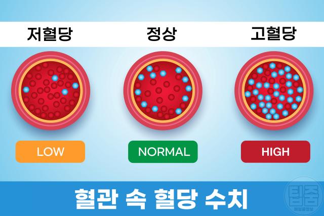 혈당이 높으면 나타나는 증상
