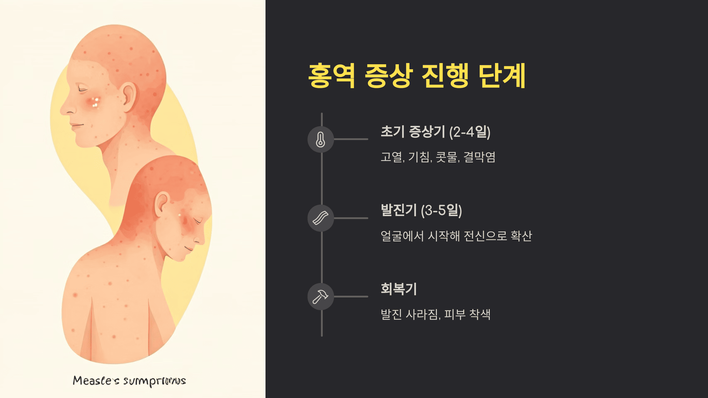 베트남 홍역 증상