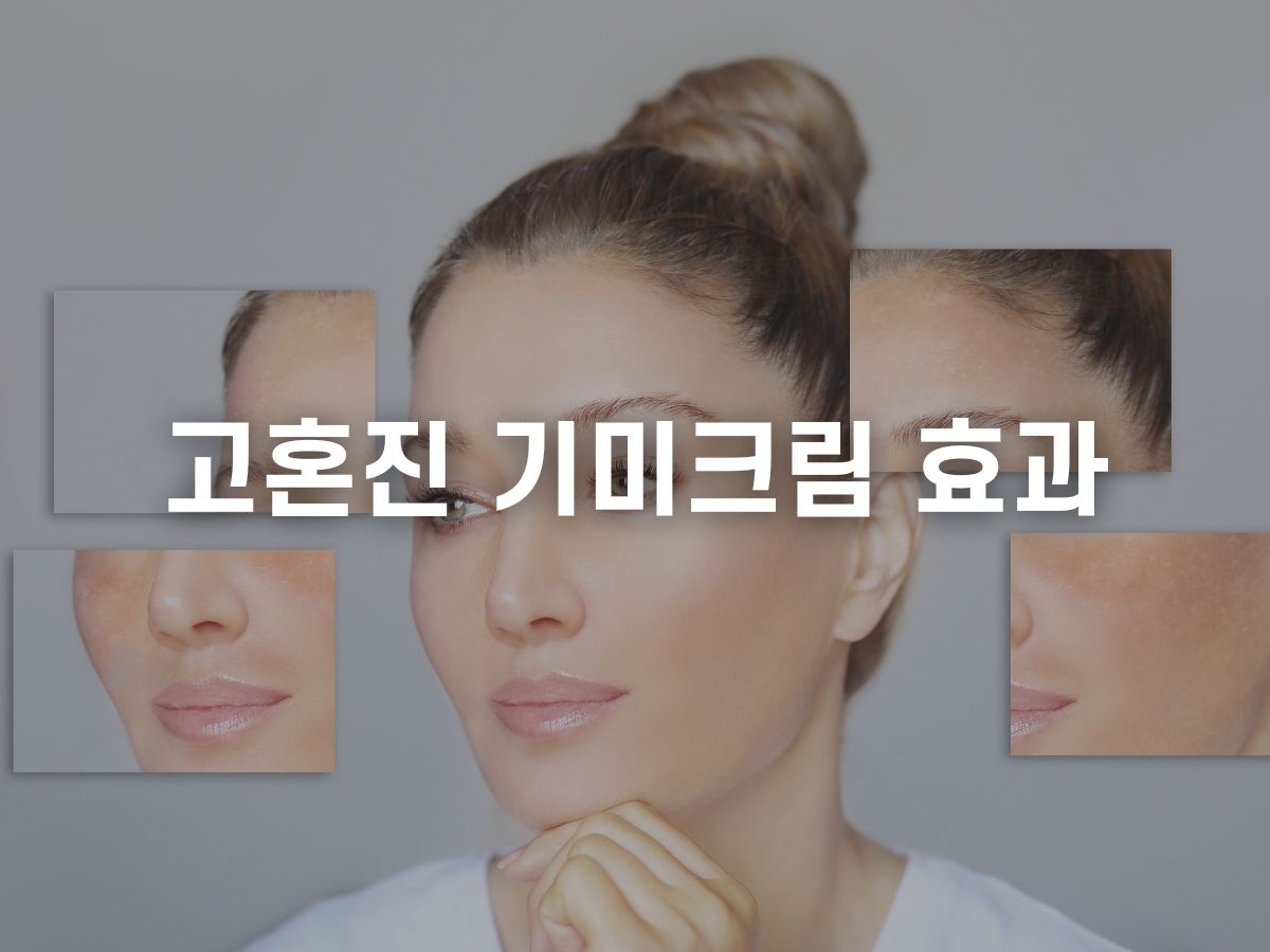 고혼진 화장품 효과 (기미크림)