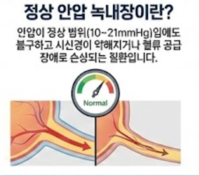 녹내장 초기증상