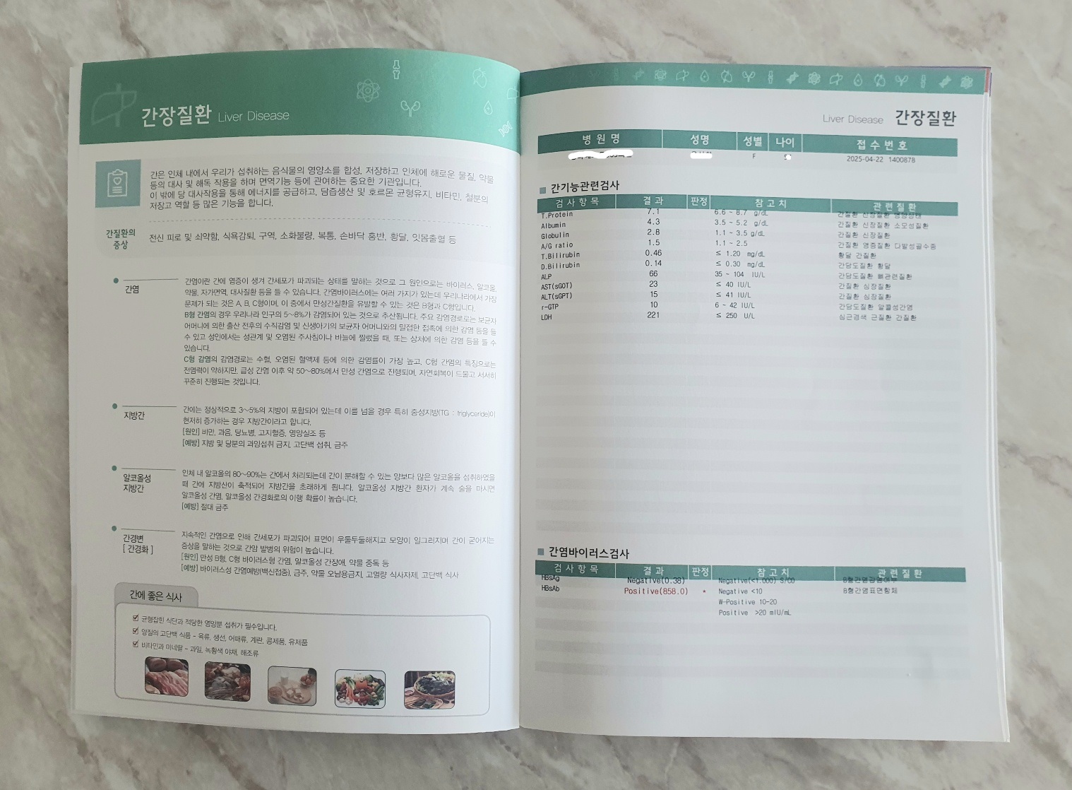 건강검진 결과지의 간장질환 항목 페이지. 간기능 관련 수치(AST, ALT, γ-GTP 등)와 간염바이러스 검사 결과가 표 형식으로 정리되어 있으며, 간에 좋은 식사 팁도 함께 안내되어 있음