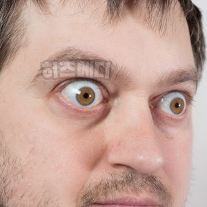 안구 건조증 증상