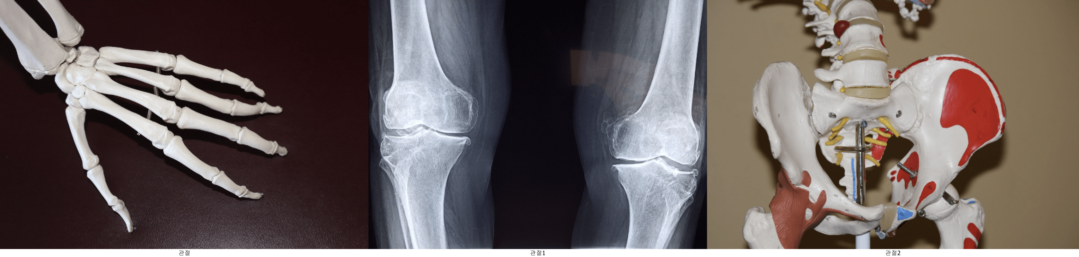 관절 건강 지원