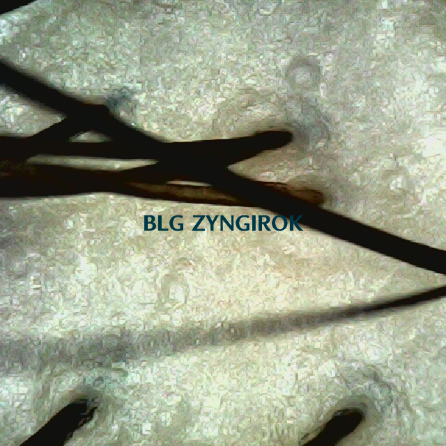 탈모 극복 프로젝트 - 정수리 두피 모습이다.