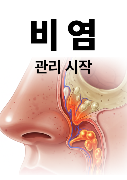 비염관리