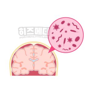 마이코플라스마 폐렴 치료 등교