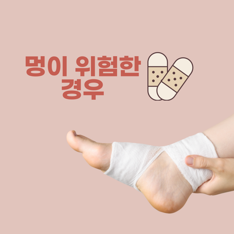 아무이유없이멍