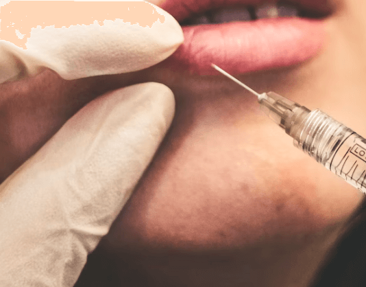 모공각화증 치료방법 - 박피 치료