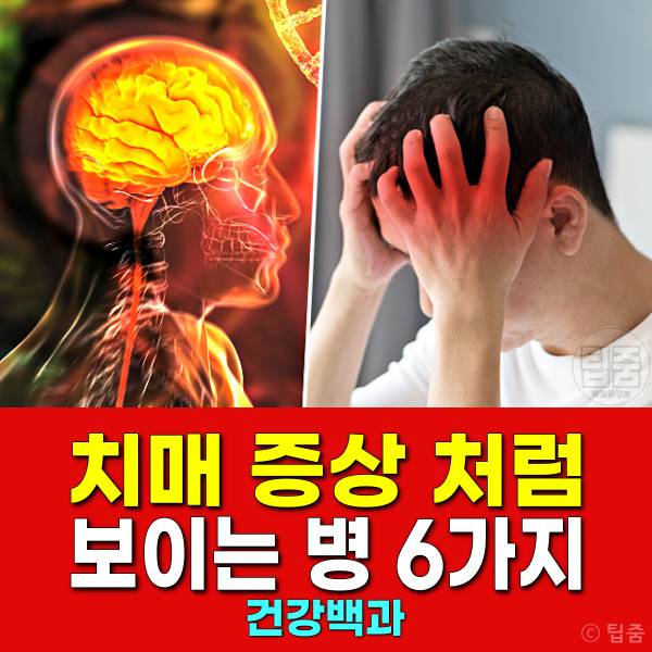 치매 증상 의심 뇌종양 갑상선 비타민 섬마 우울증
