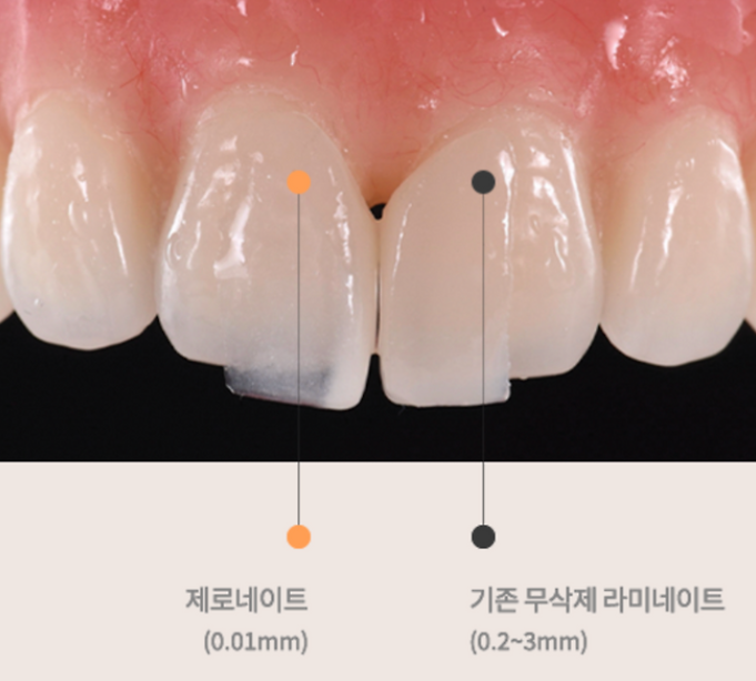 제로네이트와 라미네이트 차이점