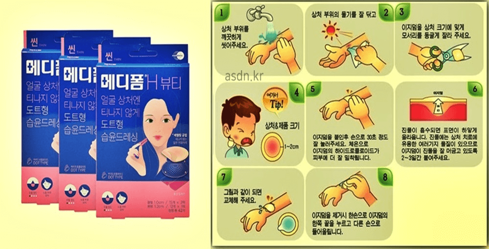 화상에 응급처지와 메디폼 사용법 총정리