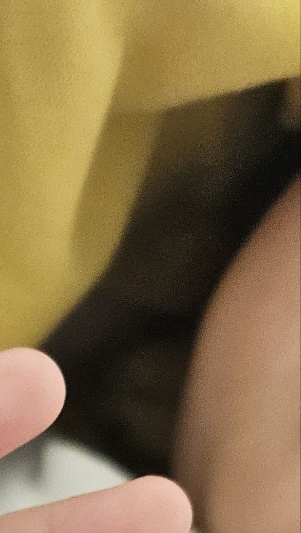 수족구병 증상 격리기간