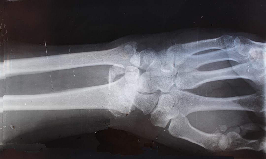 Orthopedics
