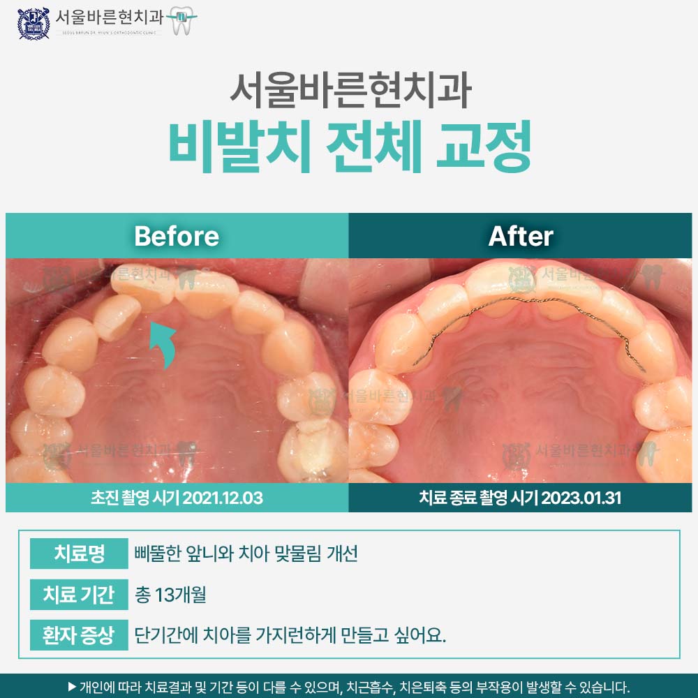 해운대치아교정