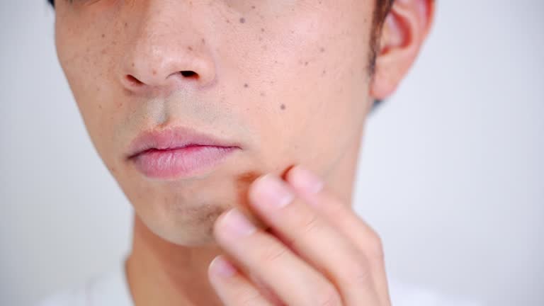 기미잡티 없애는법? 피부톤을 환하게 만드는 최신 시술 정리