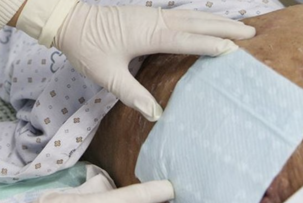 가정에서 시도 가능한 OPWT 욕창 관리법