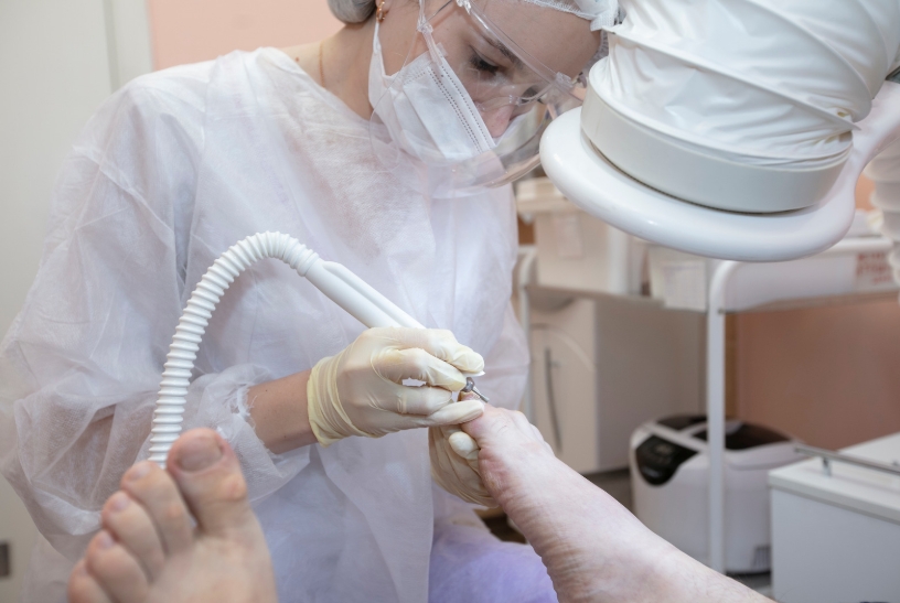 발톱무좀없애기