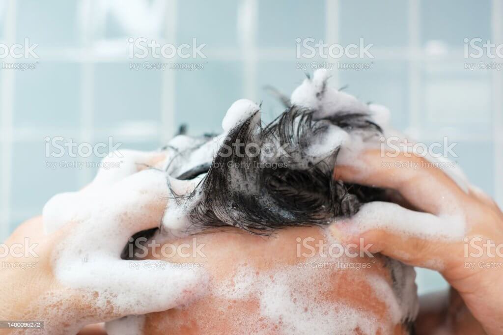 탈모 예방 방법